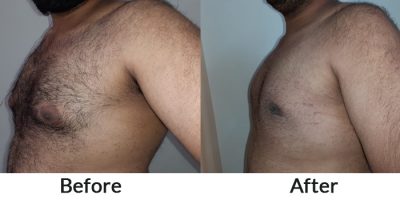 before-after1