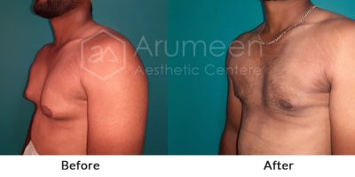 before-after2