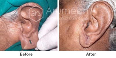 before-after5