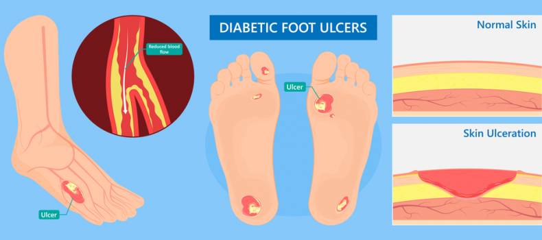 diabetic6 diabetic6