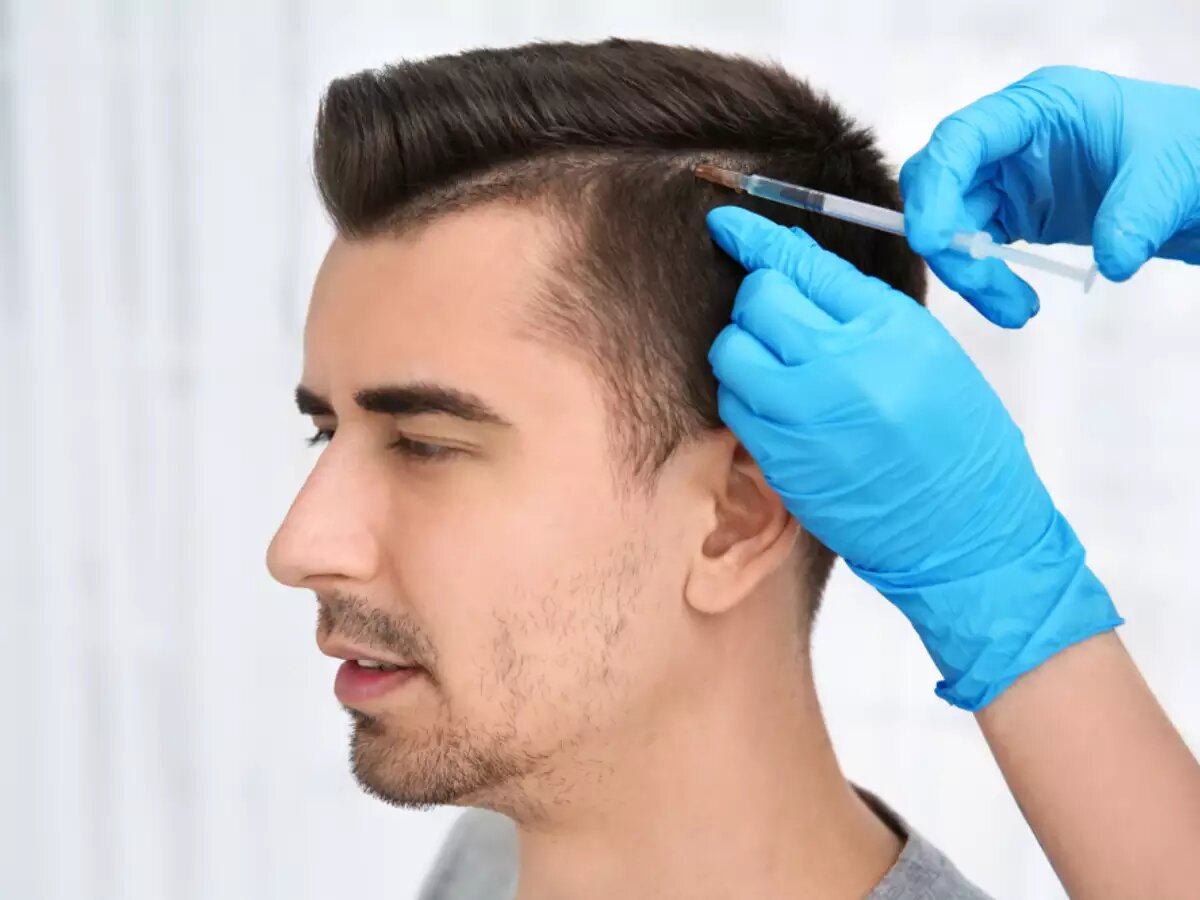 Blogimage-hairfall-hairtransplantation Blogimage-hairfall-hairtransplantation