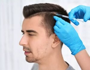 imgi_10_Blogimage-hairfall-hairtransplantation