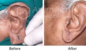 imgi_18_before-after5